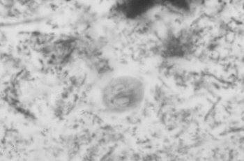 Giardia spp. as seen in a fecal smear